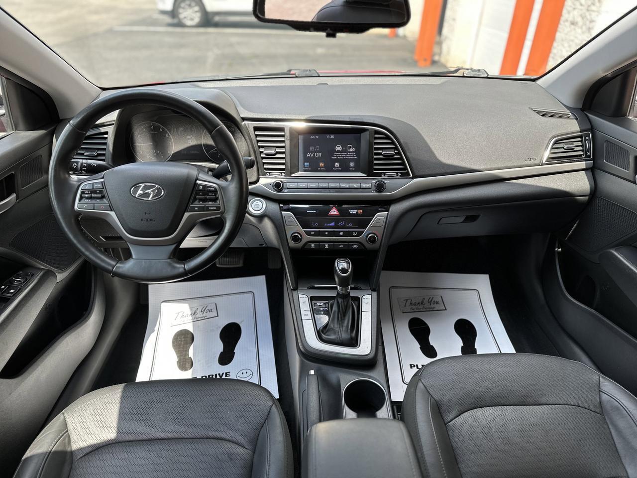 2017 Hyundai Elantra
