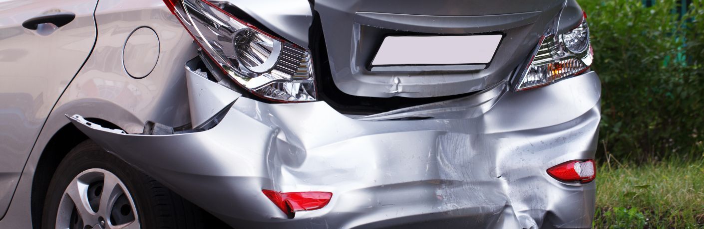 Vehicle dent and scratch