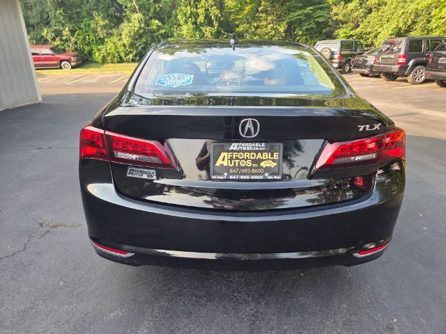 2017 Acura TLX w/Technology Package Elgin IL