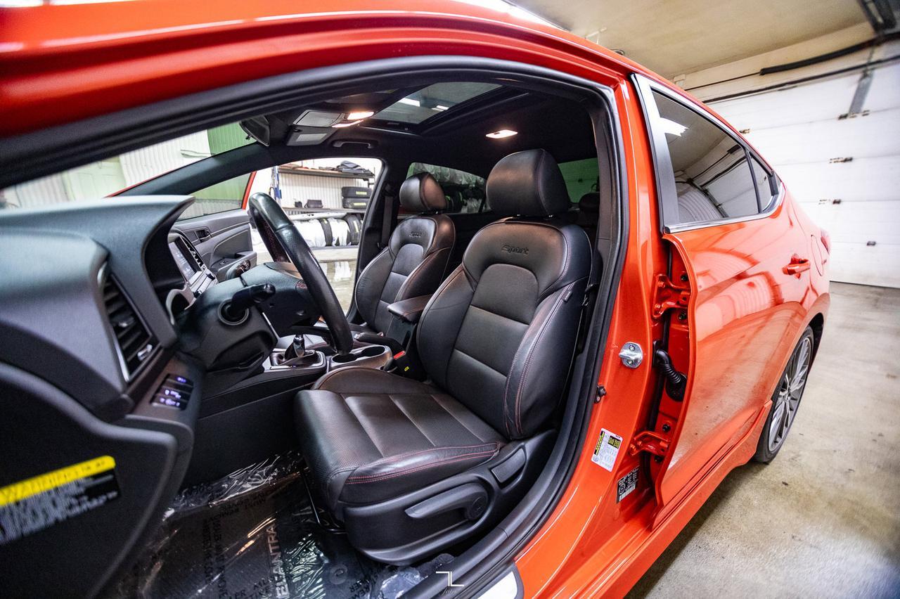 2017 Hyundai Elantra Sport Manual Leather Roof BCam Red Deer AB