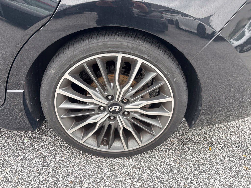 2017 Hyundai Elantra Sport Cockeysville MD