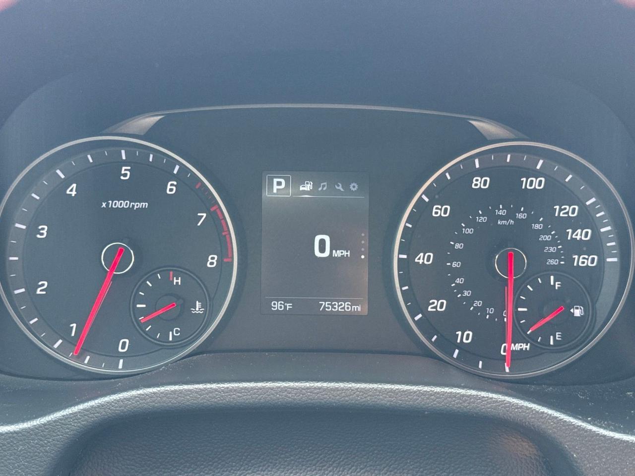 2018 Hyundai Elantra Sport Chantilly VA