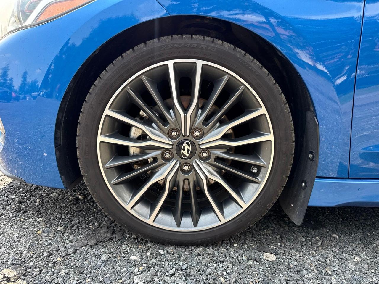 2018 Hyundai Elantra Sport Chantilly VA