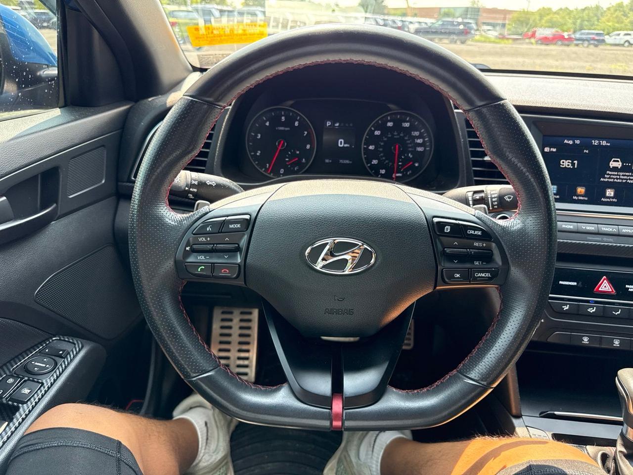 2018 Hyundai Elantra Sport Chantilly VA