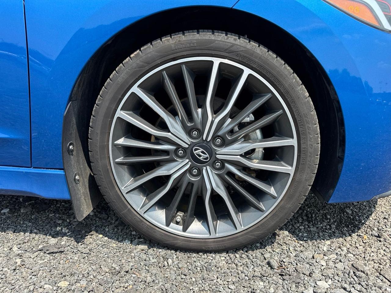 2018 Hyundai Elantra Sport Chantilly VA
