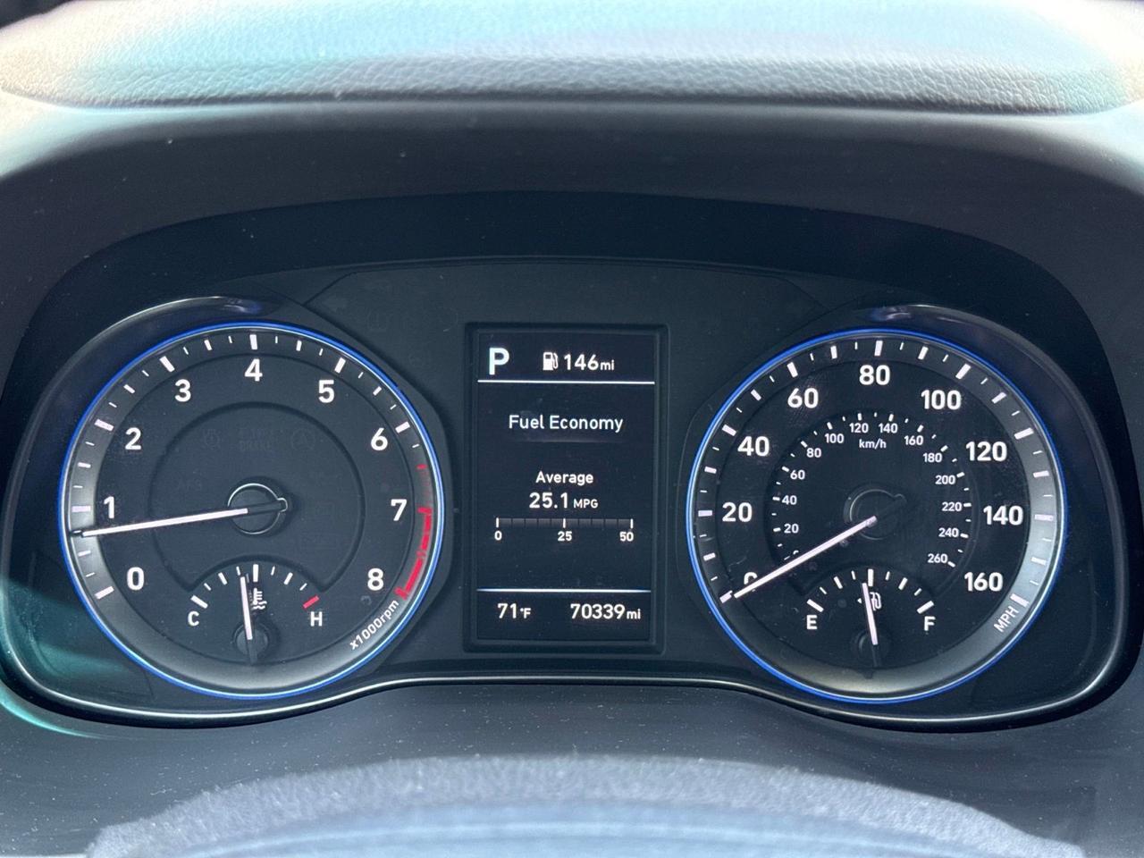 2019 Hyundai Kona Ultimate Chantilly VA