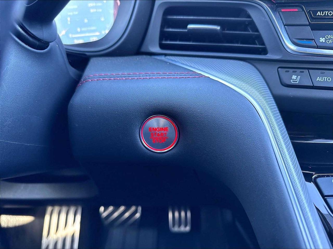 2025 Acura TLX w/A-Spec Package Roseville CA