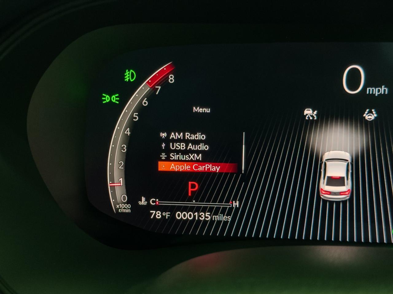 2025 Acura TLX w/A-Spec Package SH-AWD Tallmadge OH