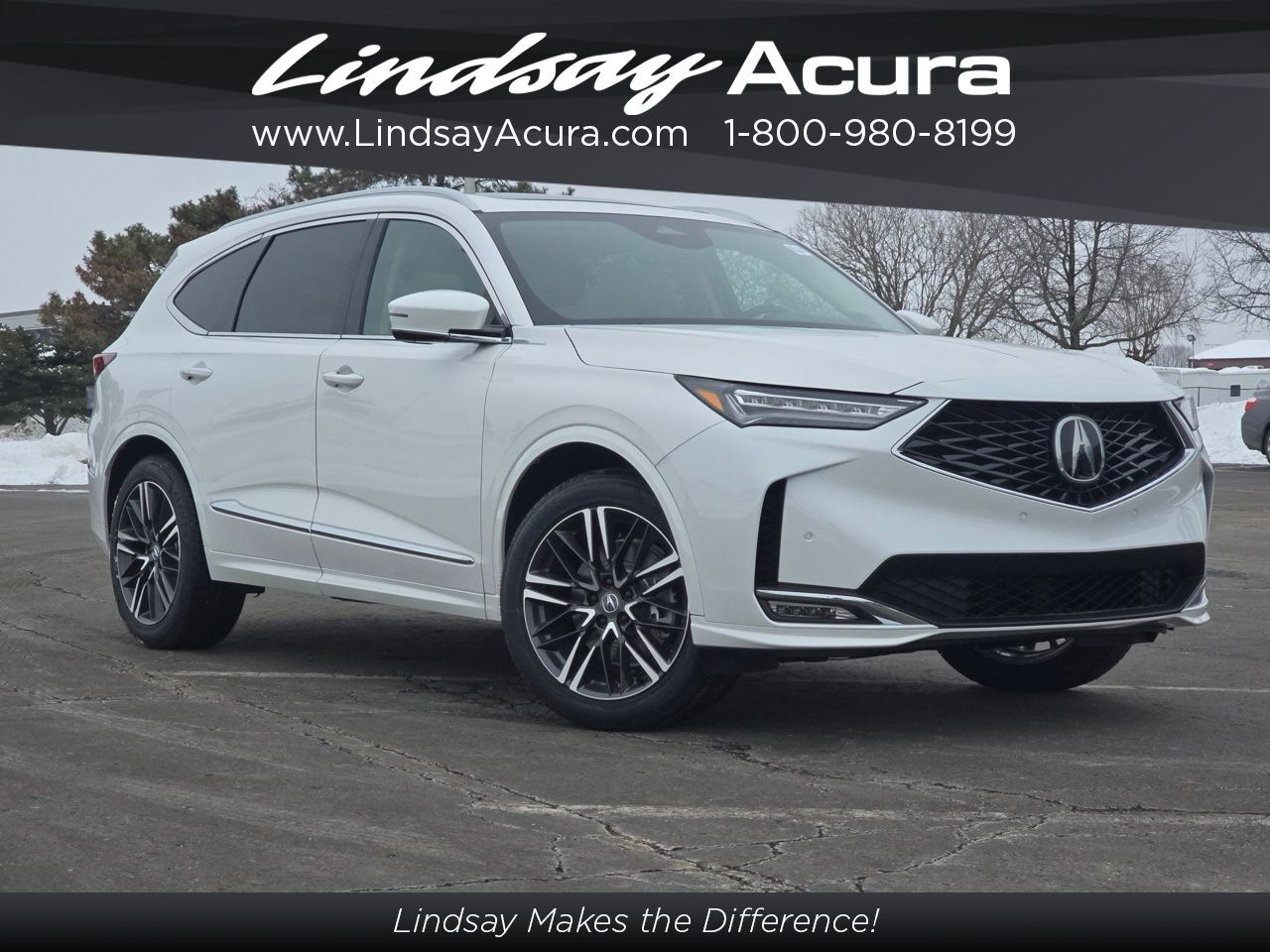 2026 Acura MDX Advance Package
