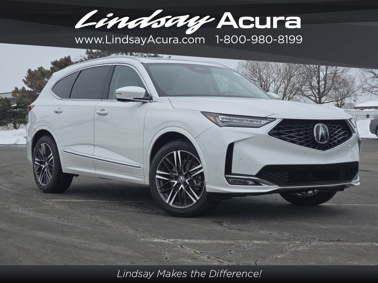 2026 Acura MDX Advance Package